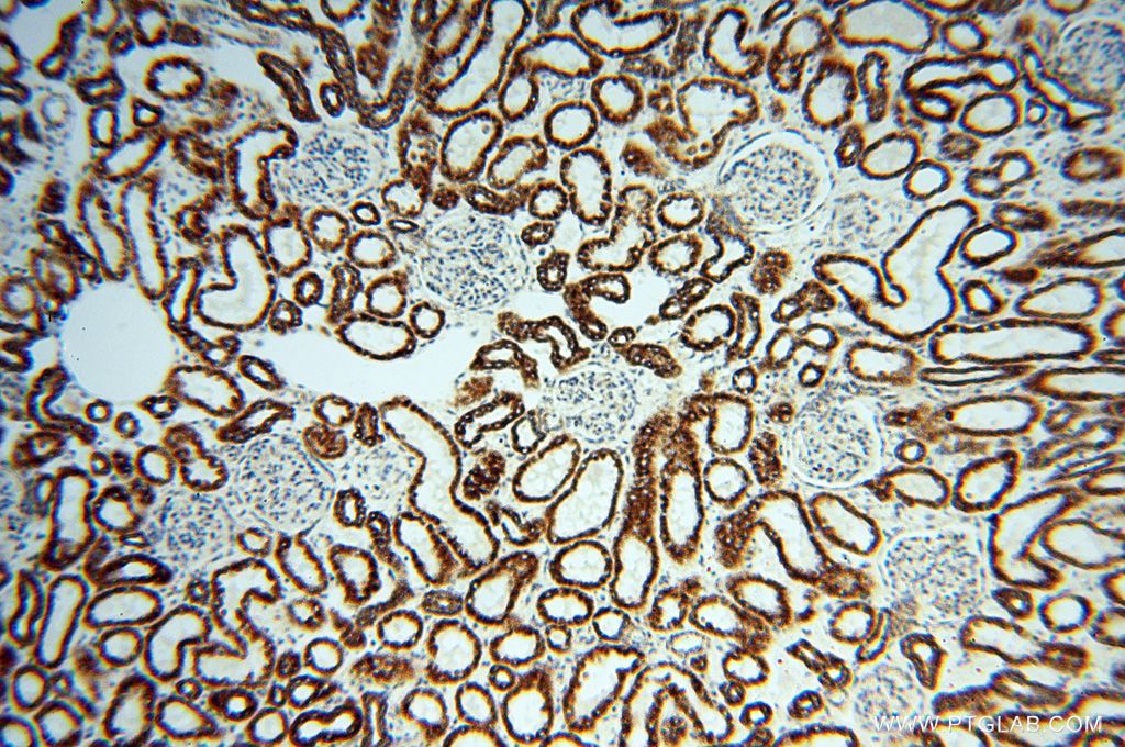 Immunohistochemistry (IHC) staining of human kidney tissue using NDUFB7 Polyclonal antibody (14912-1-AP)
