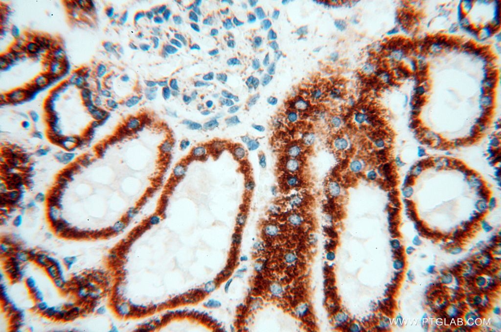Immunohistochemistry (IHC) staining of human kidney tissue using NDUFB7 Polyclonal antibody (14912-1-AP)