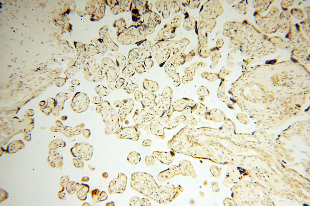 Immunohistochemistry (IHC) staining of human placenta tissue using NDUFB7 Polyclonal antibody (14912-1-AP)