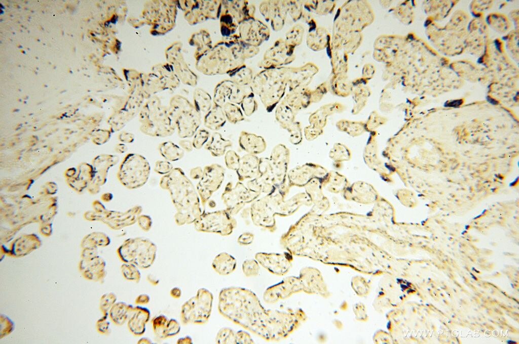 IHC staining of human placenta using 14912-1-AP