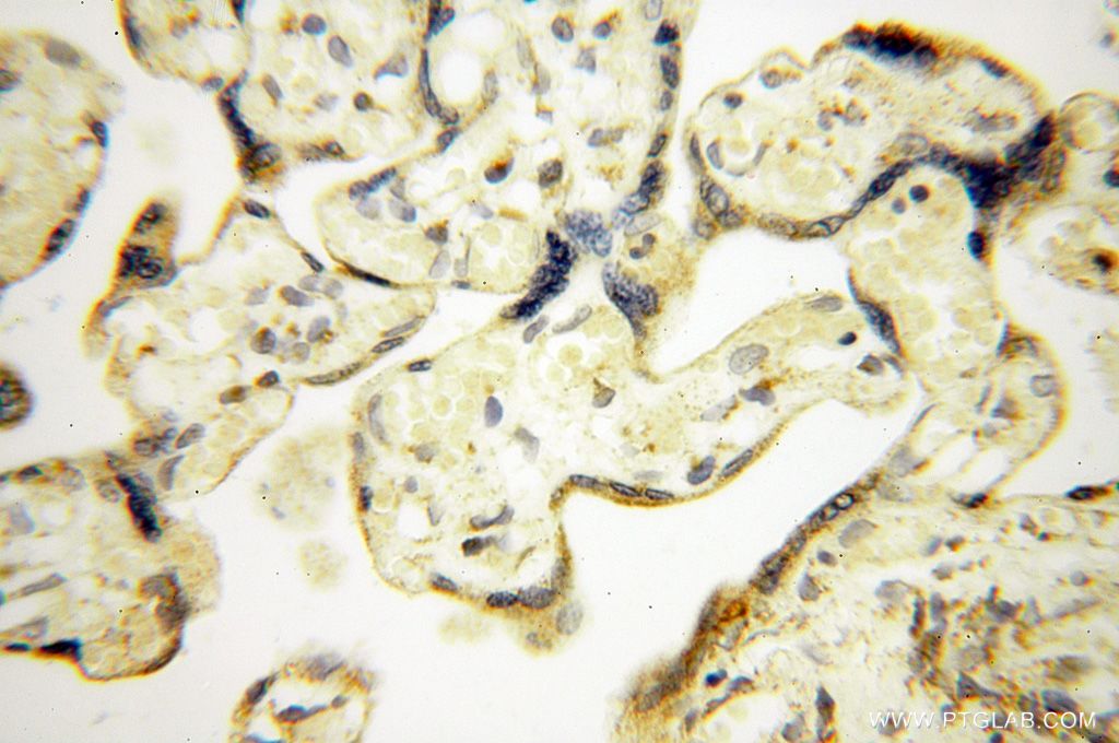 Immunohistochemistry (IHC) staining of human placenta tissue using NDUFB7 Polyclonal antibody (14912-1-AP)