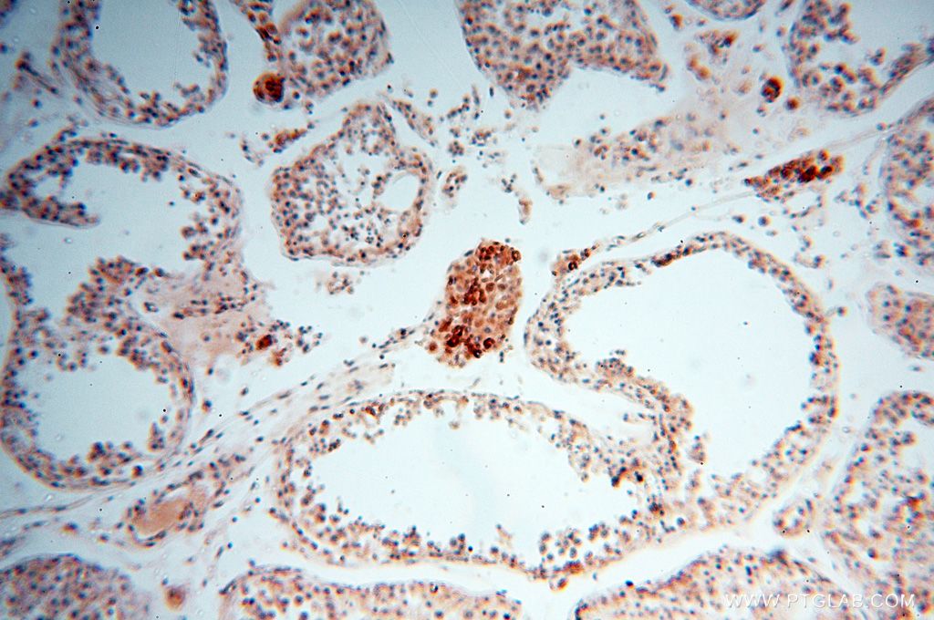 Immunohistochemistry (IHC) staining of human testis tissue using NDUFB7 Polyclonal antibody (14912-1-AP)