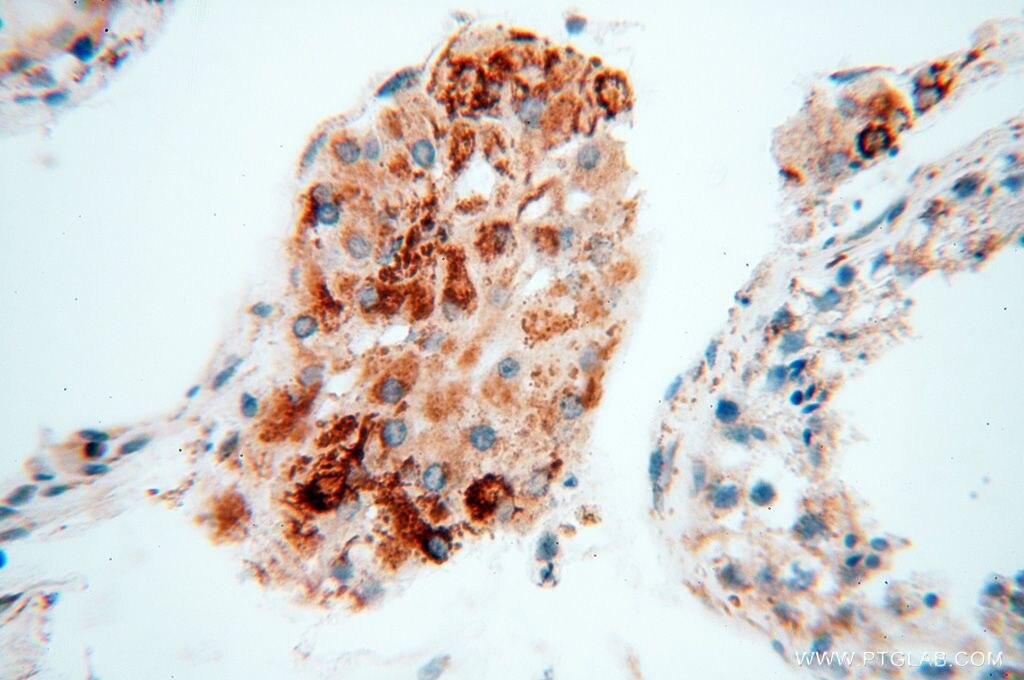 IHC staining of human testis using 14912-1-AP