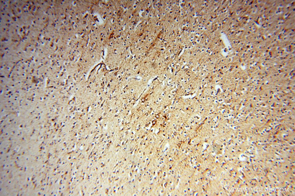Immunohistochemistry (IHC) staining of human brain tissue using NDUFB7 Polyclonal antibody (14912-1-AP)