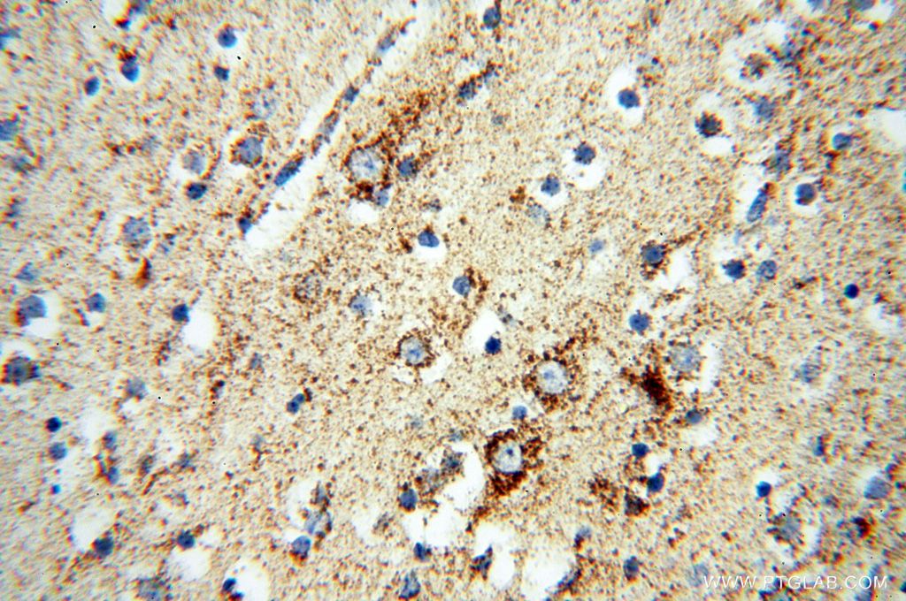 Immunohistochemistry (IHC) staining of human brain tissue using NDUFB7 Polyclonal antibody (14912-1-AP)