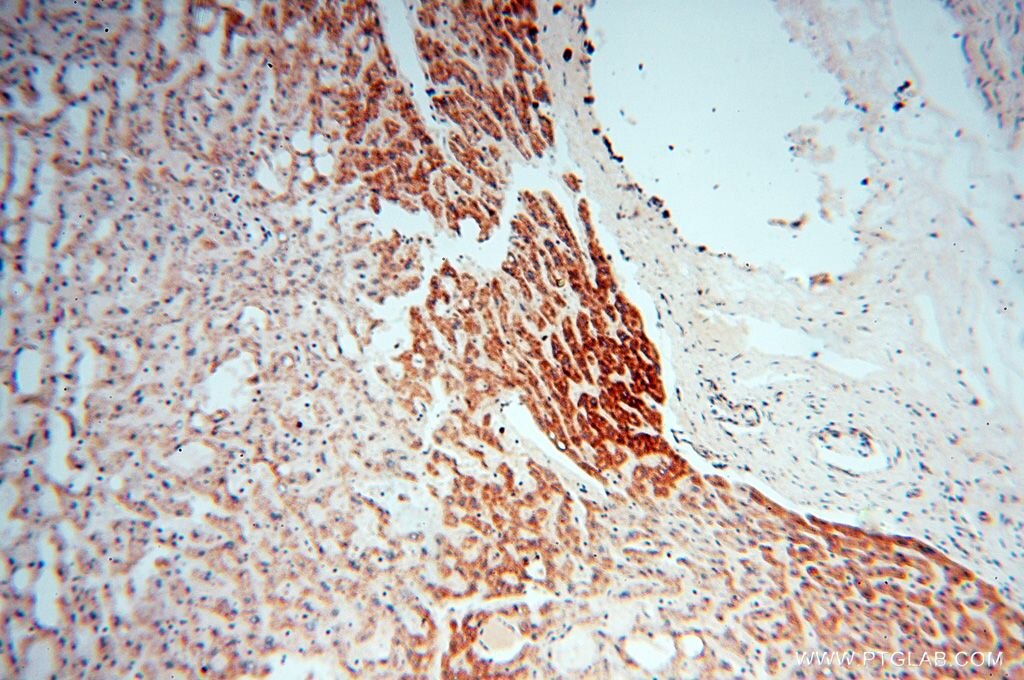 Immunohistochemistry (IHC) staining of human liver tissue using NDUFB7 Polyclonal antibody (14912-1-AP)