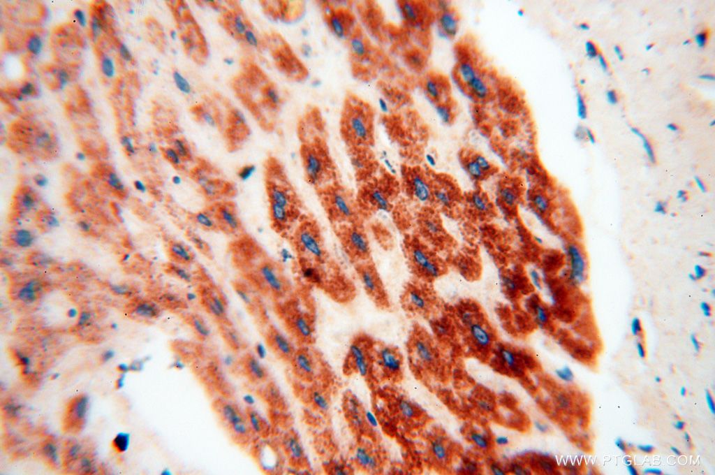 Immunohistochemistry (IHC) staining of human liver tissue using NDUFB7 Polyclonal antibody (14912-1-AP)
