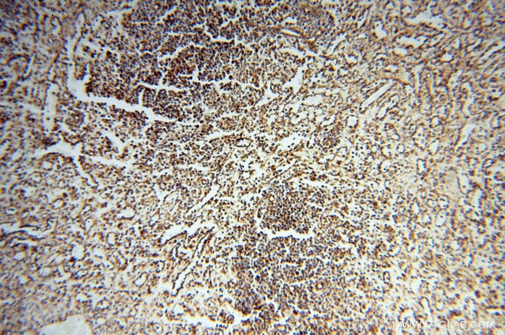 Immunohistochemistry (IHC) staining of human spleen tissue using NDUFB7 Polyclonal antibody (14912-1-AP)