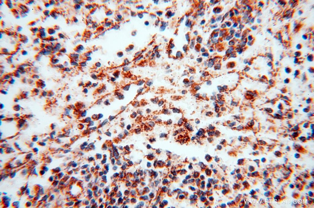 Immunohistochemistry (IHC) staining of human spleen tissue using NDUFB7 Polyclonal antibody (14912-1-AP)
