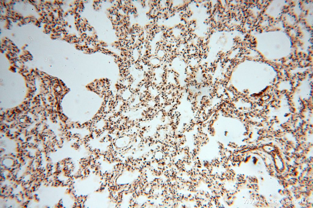 Immunohistochemistry (IHC) staining of human lung tissue using NDUFB7 Polyclonal antibody (14912-1-AP)