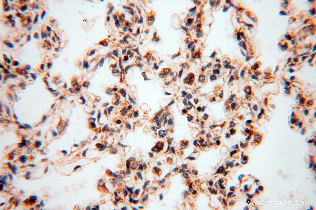 Immunohistochemistry (IHC) staining of human lung tissue using NDUFB7 Polyclonal antibody (14912-1-AP)