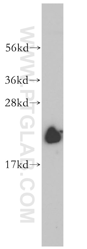 Western Blot (WB) analysis of MCF-7 cells using NDUFB7 Polyclonal antibody (14912-1-AP)