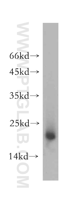 Western Blot (WB) analysis of mouse brain tissue using NDUFB7 Polyclonal antibody (14912-1-AP)