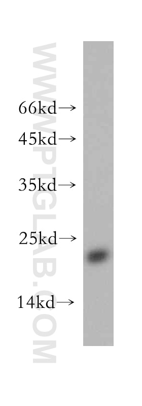 Western Blot (WB) analysis of MCF-7 cells using NDUFB7 Polyclonal antibody (14912-1-AP)