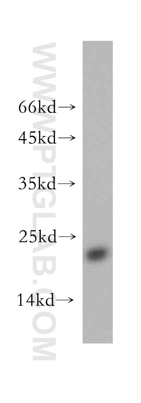 WB analysis of MCF-7 using 14912-1-AP