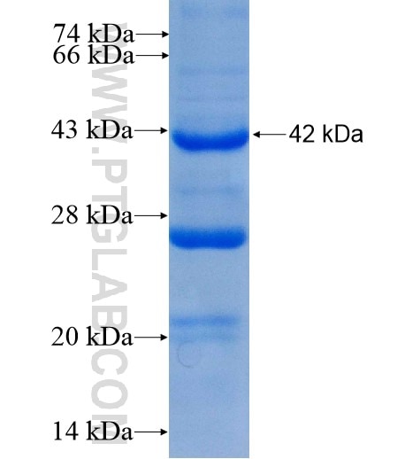 NDUFB7 fusion protein Ag6709 SDS-PAGE