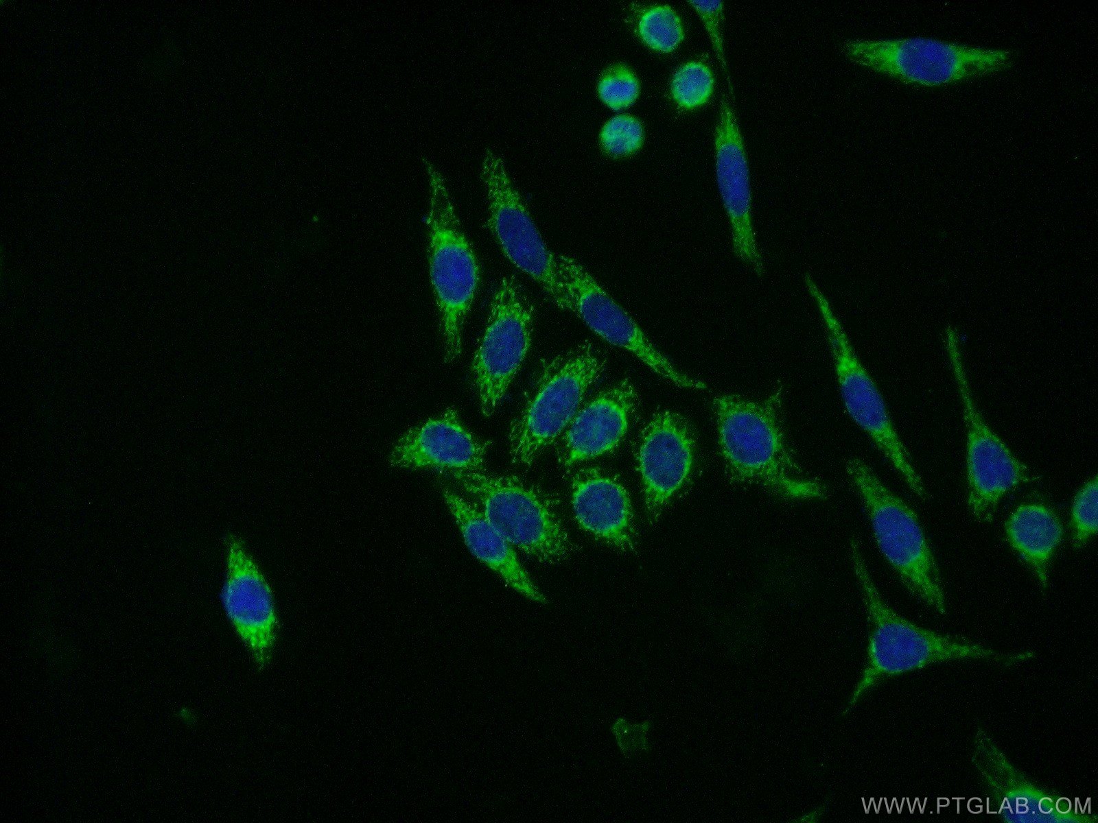 NDUFB8 Polyclonal antibody