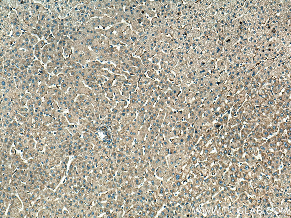 Immunohistochemistry (IHC) staining of human liver tissue using NDUFB8 Polyclonal antibody (14794-1-AP)