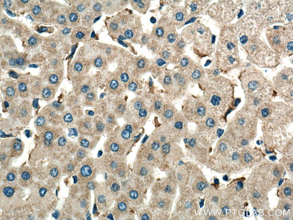 Immunohistochemistry (IHC) staining of human liver tissue using NDUFB8 Polyclonal antibody (14794-1-AP)
