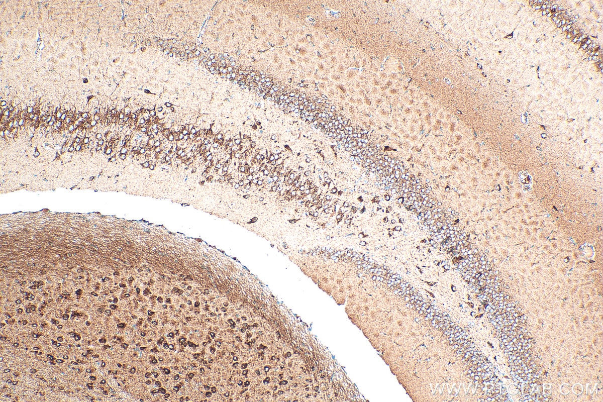 Immunohistochemistry (IHC) staining of mouse brain tissue using NDUFB8 Polyclonal antibody (14794-1-AP)
