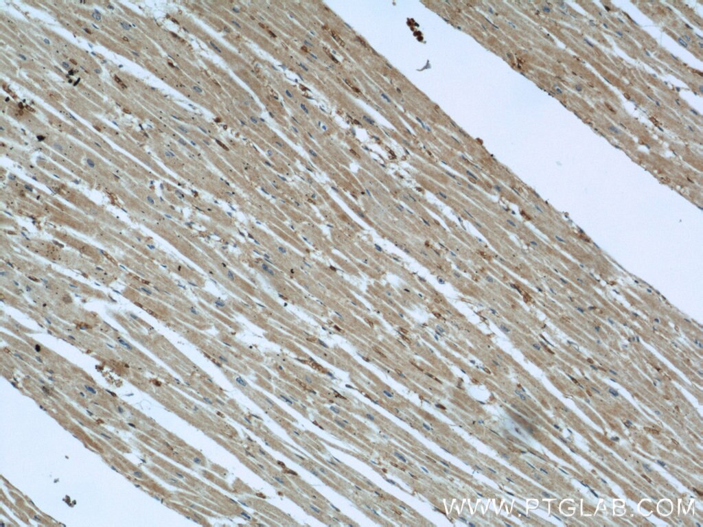 IHC staining of human heart using 14794-1-AP