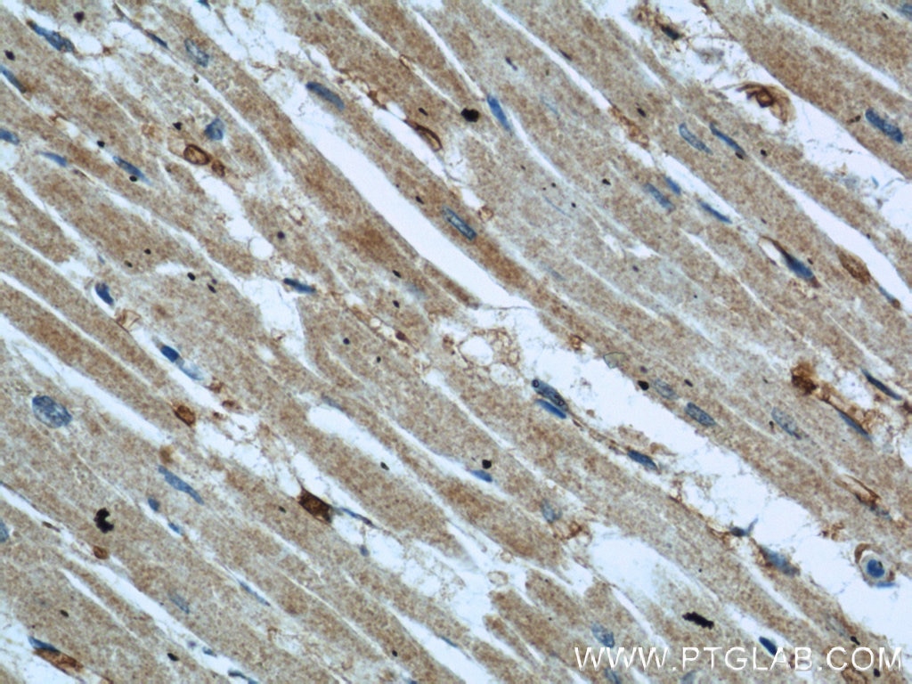 Immunohistochemistry (IHC) staining of human heart tissue using NDUFB8 Polyclonal antibody (14794-1-AP)