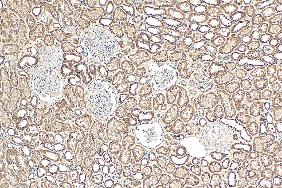 Immunohistochemistry (IHC) staining of human kidney tissue using NDUFB8 Monoclonal antibody (67690-1-Ig)