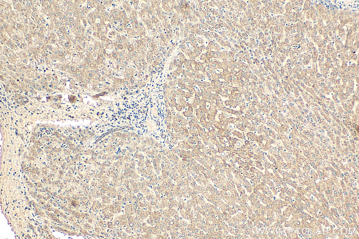 Immunohistochemistry (IHC) staining of human liver tissue using NDUFB8 Monoclonal antibody (67690-1-Ig)