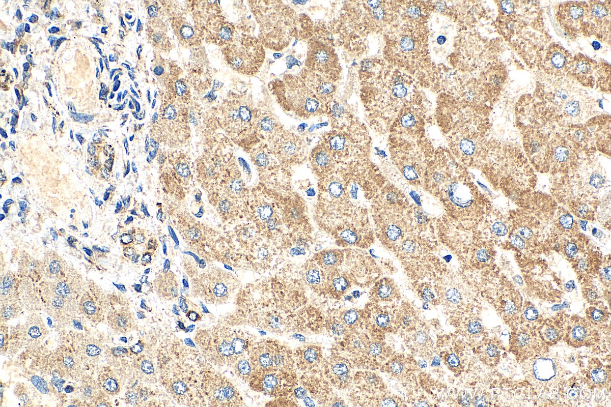 Immunohistochemistry (IHC) staining of human liver tissue using NDUFB8 Monoclonal antibody (67690-1-Ig)