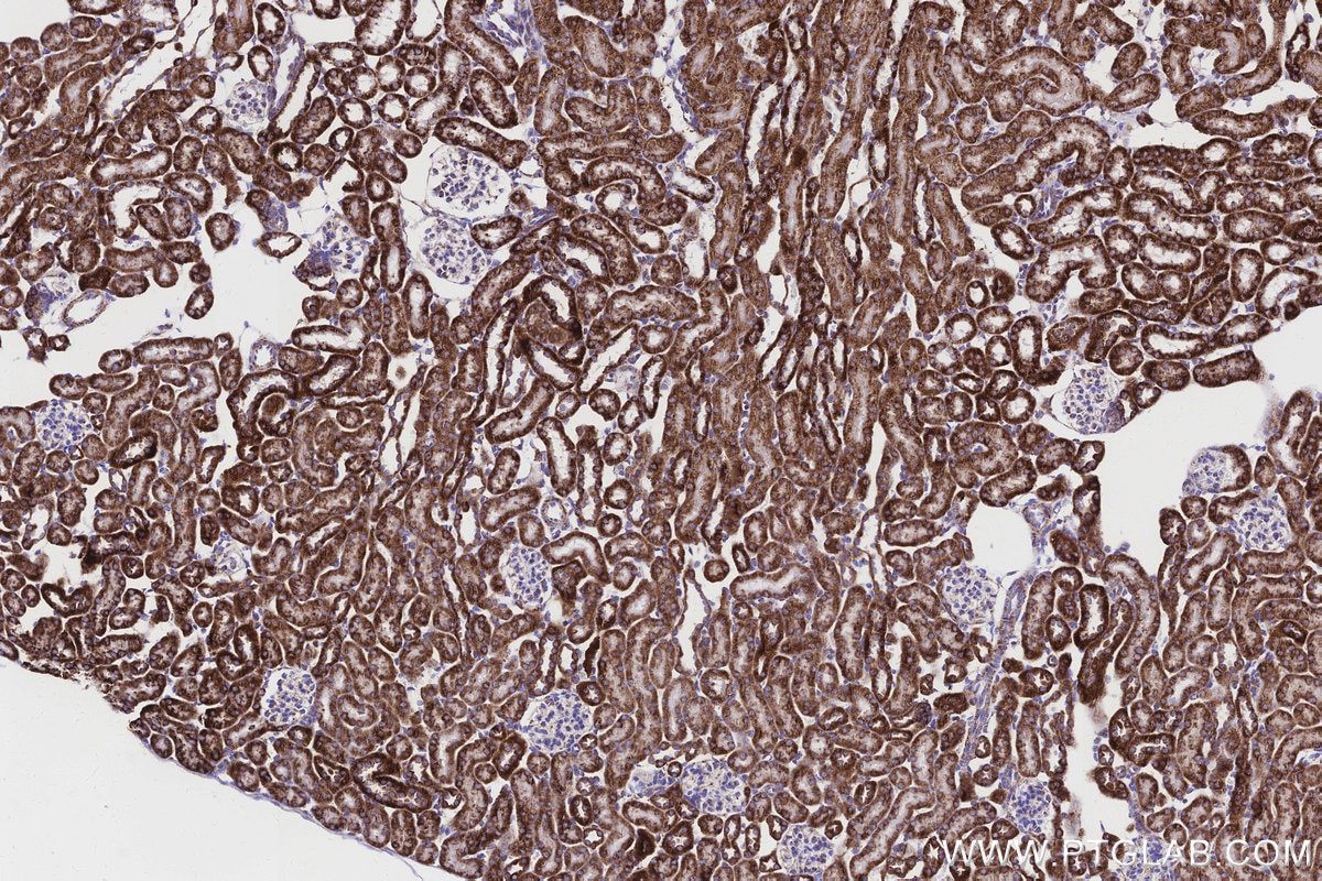 IHC staining of mouse kidney using 83216-3-RR Immunohistochemistry (IHC) staining of mouse kidney tissue using NDUFB8 Recombinant monoclonal antibody (83216-3-RR)