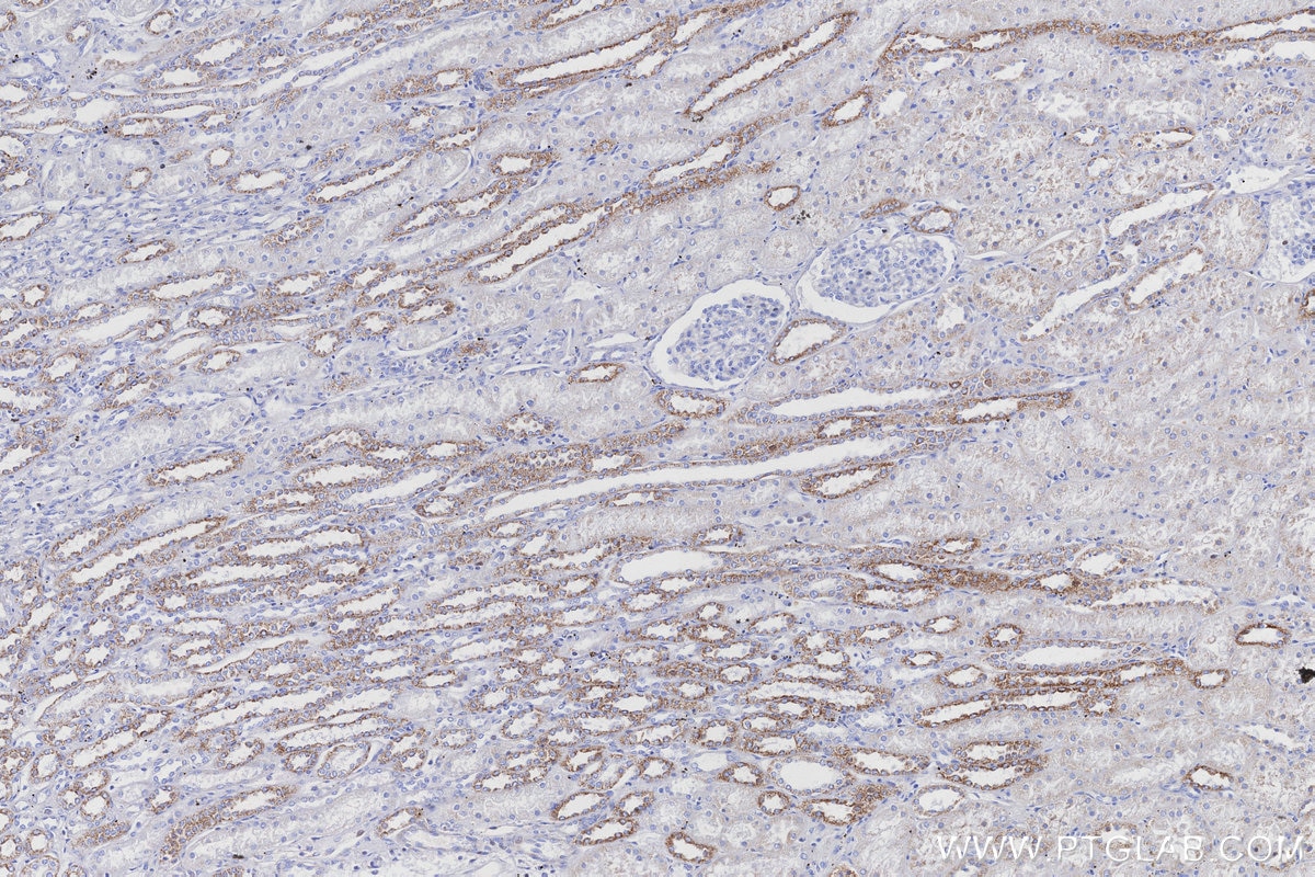 IHC staining of human kidney using 83216-3-RR Immunohistochemistry (IHC) staining of human kidney tissue using NDUFB8 Recombinant monoclonal antibody (83216-3-RR)