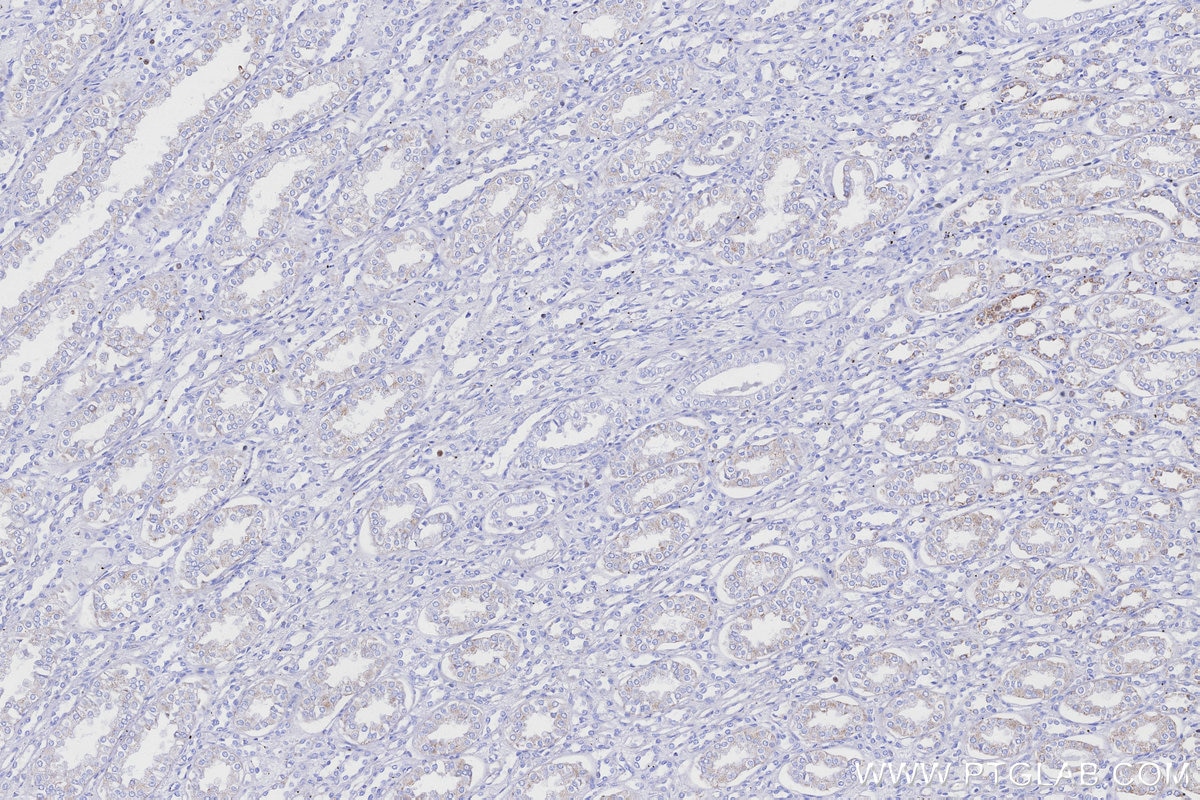 IHC staining of human kidney using 83216-3-RR Immunohistochemistry (IHC) staining of human kidney tissue using NDUFB8 Recombinant monoclonal antibody (83216-3-RR)