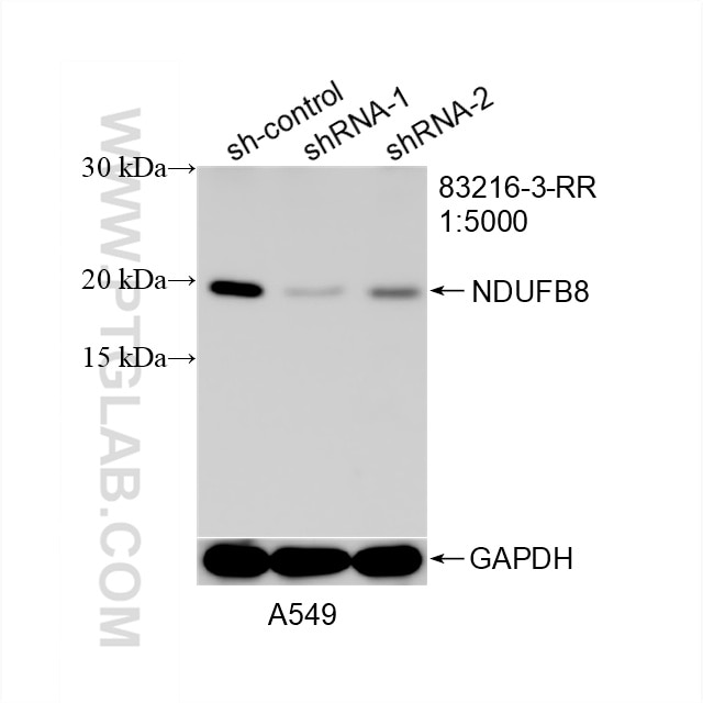 Western Blot (WB) analysis of A549 cells using NDUFB8 Recombinant antibody (83216-3-RR)