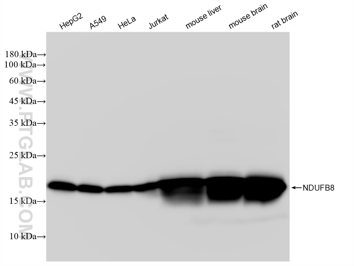 Western Blot (WB) analysis of various lysates using NDUFB8 Recombinant antibody (83216-4-RR)