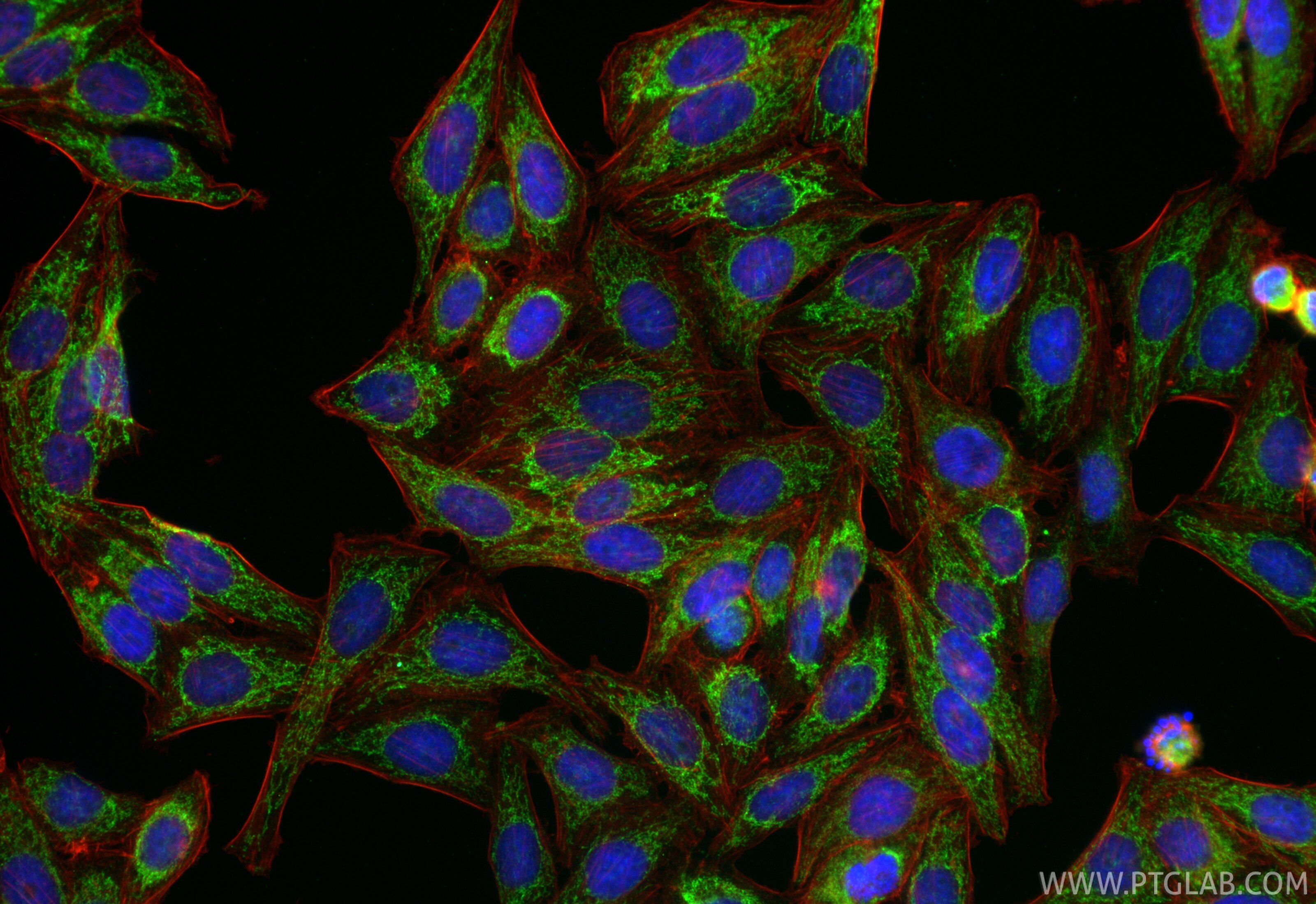 IF Staining of HepG2 using RMX00097 Immunofluorescence (IF) / fluorescent staining of HepG2 cells using Multi-rAb® NDUFB8 Multi-Recombinant antibody (RMX00097)