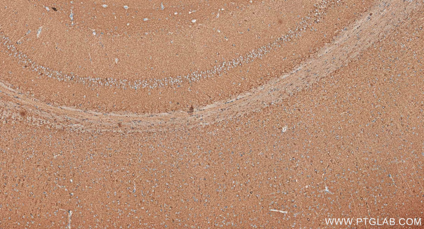 IHC staining of mouse brain using RMX00097 Immunohistochemistry (IHC) staining of mouse brain tissue using Multi-rAb® NDUFB8 Multi-Recombinant antibody (RMX00097)