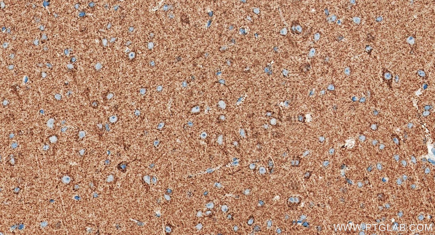 IHC staining of mouse brain using RMX00097 Immunohistochemistry (IHC) staining of mouse brain tissue using Multi-rAb® NDUFB8 Multi-Recombinant antibody (RMX00097)