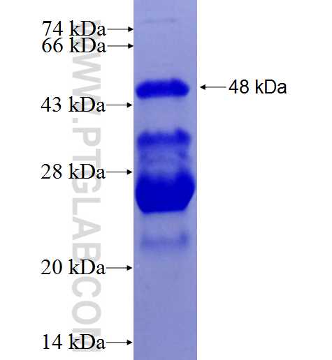 NDUFB8 fusion protein Ag6495 SDS-PAGE