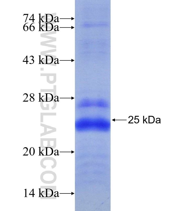 NDUFB8 fusion protein Ag6569 SDS-PAGE