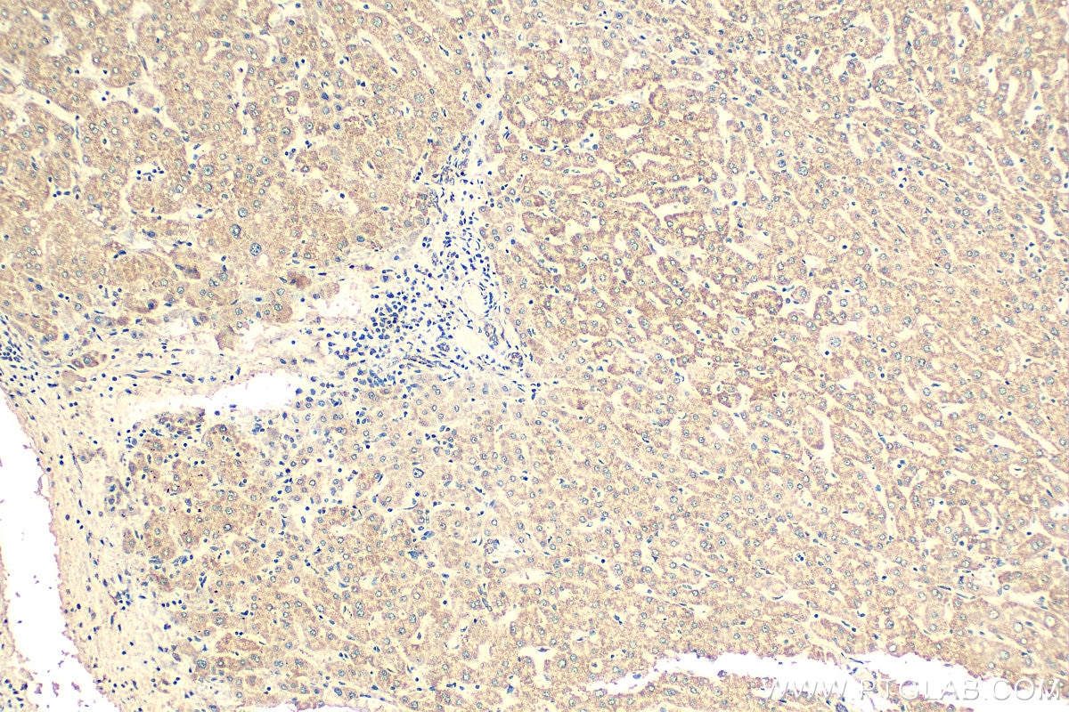 Immunohistochemistry (IHC) staining of human liver tissue using NDUFB9 Polyclonal antibody (15572-1-AP)