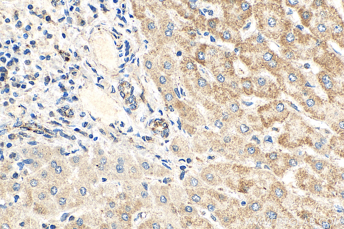 Immunohistochemistry (IHC) staining of human liver tissue using NDUFB9 Polyclonal antibody (15572-1-AP)