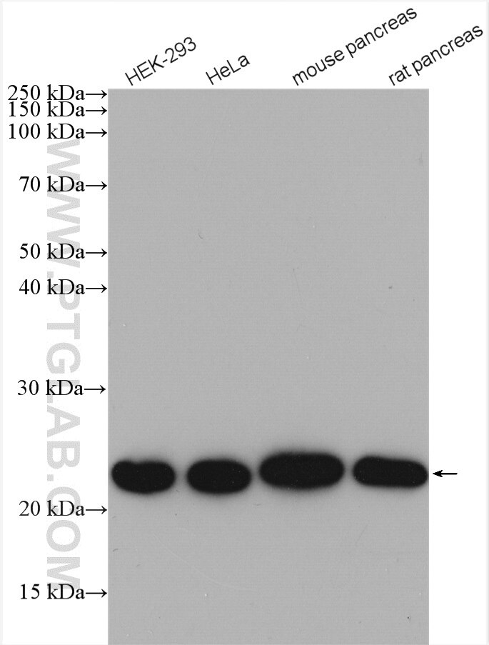 Western Blot (WB) analysis of various lysates using NDUFB9 Polyclonal antibody (15572-1-AP)