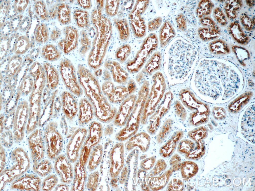 Immunohistochemistry (IHC) staining of human kidney tissue using NDUFC1 Polyclonal antibody (23842-1-AP)