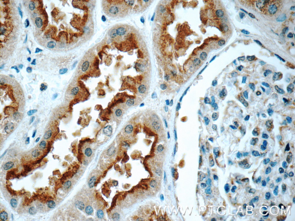 IHC staining of human kidney using 23842-1-AP