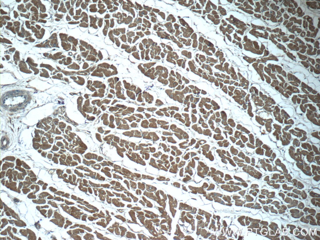 Immunohistochemistry (IHC) staining of human heart tissue using NDUFC1 Polyclonal antibody (23842-1-AP)