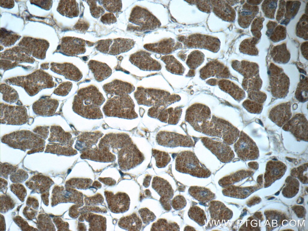 Immunohistochemistry (IHC) staining of human heart tissue using NDUFC1 Polyclonal antibody (23842-1-AP)