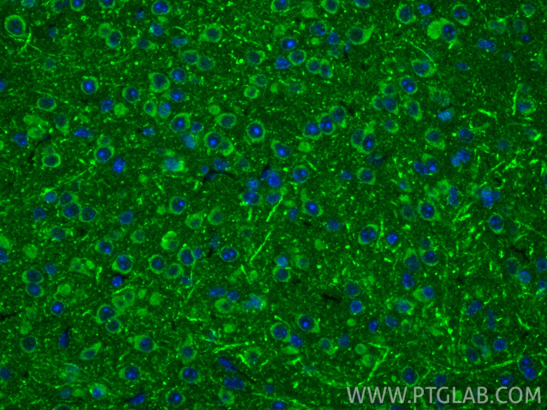 Immunofluorescence (IF) / fluorescent staining of mouse brain tissue using NDUFC2 Polyclonal antibody (15573-1-AP)