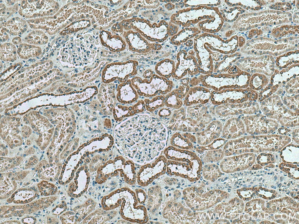 Immunohistochemistry (IHC) staining of human kidney tissue using NDUFC2 Polyclonal antibody (15573-1-AP)