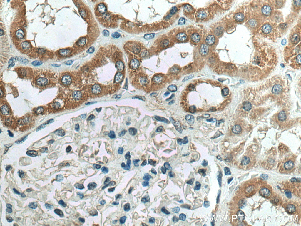 Immunohistochemistry (IHC) staining of human kidney tissue using NDUFC2 Polyclonal antibody (15573-1-AP)