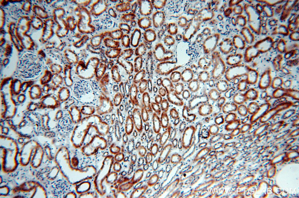 Immunohistochemistry (IHC) staining of human kidney tissue using NDUFC2 Polyclonal antibody (15573-1-AP)